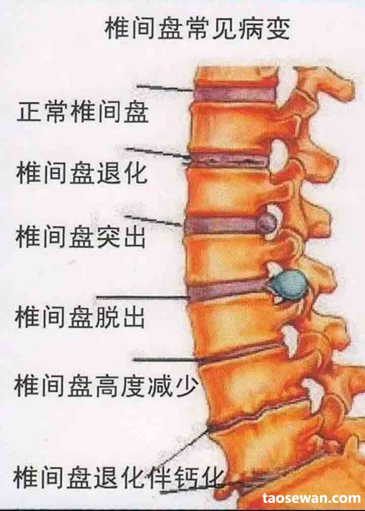 002859egii4cuccyniqxgx.jpg