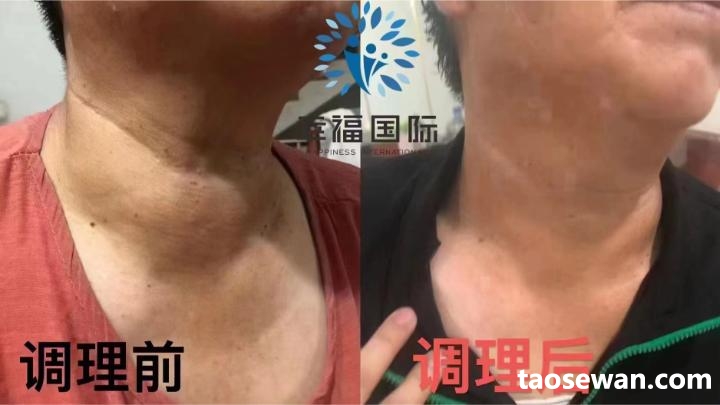 013545c5iclwr5iqiira63.jpg